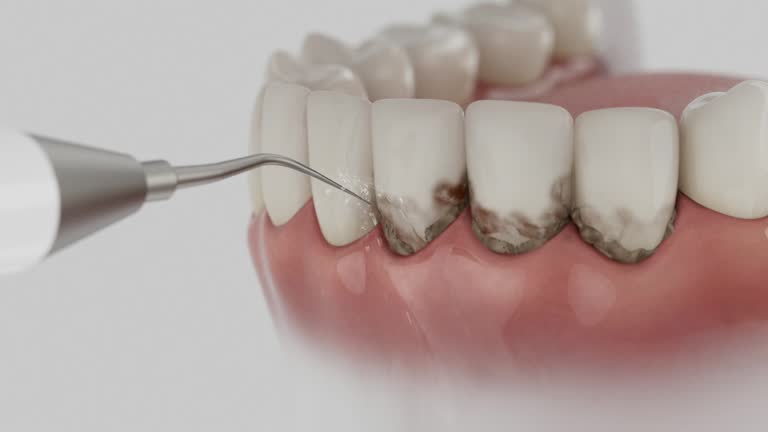 Trusted Teeth Cleaning And Checkup service in Lake Mills, IA - Dentist Open Now